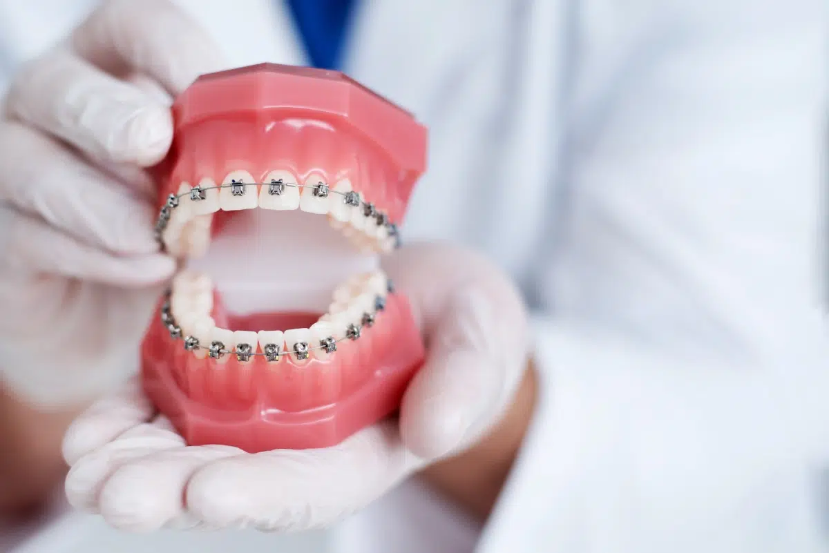 Orthodontiste à Aulnay-sous-Bois