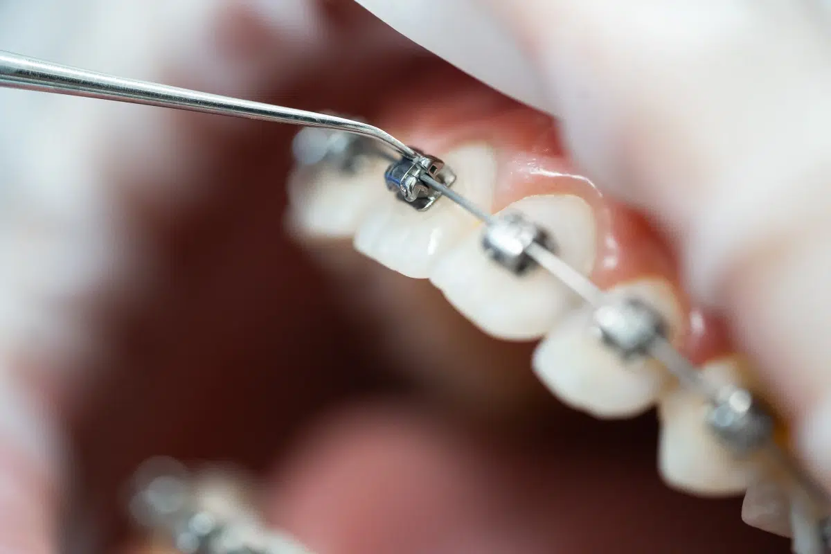Orthodontiste à Aulnay-sous-Bois