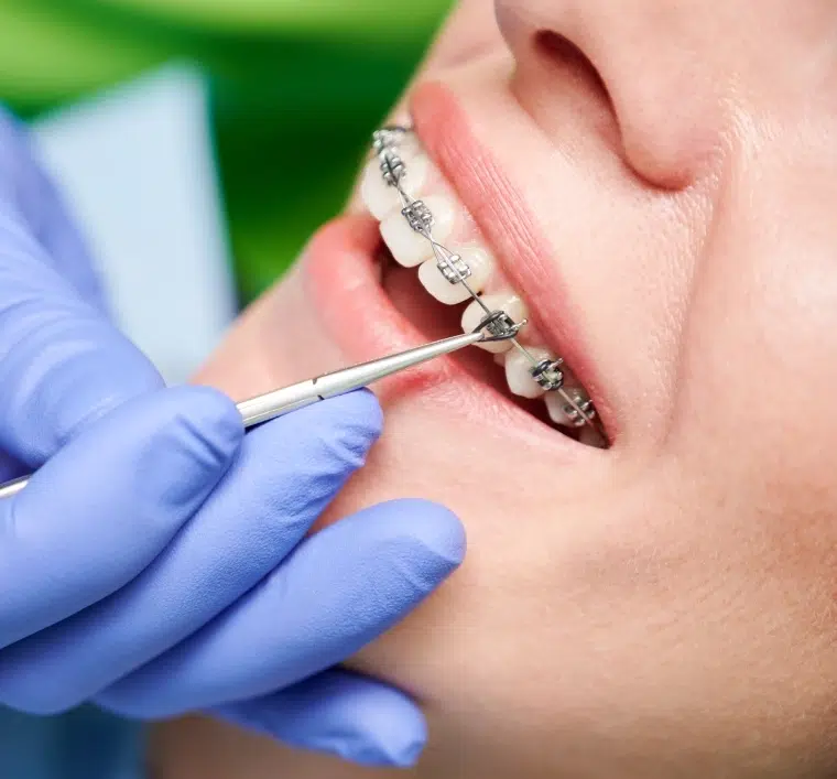 Orthodontiste à Aulnay-sous-Bois